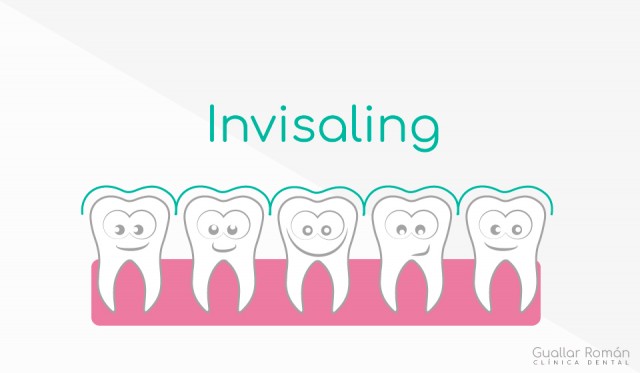 ortodoncia invisible Invisaling